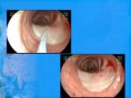 /album/angiodisplasia-dra-marta-agudelo/diapositiva4-jpg/